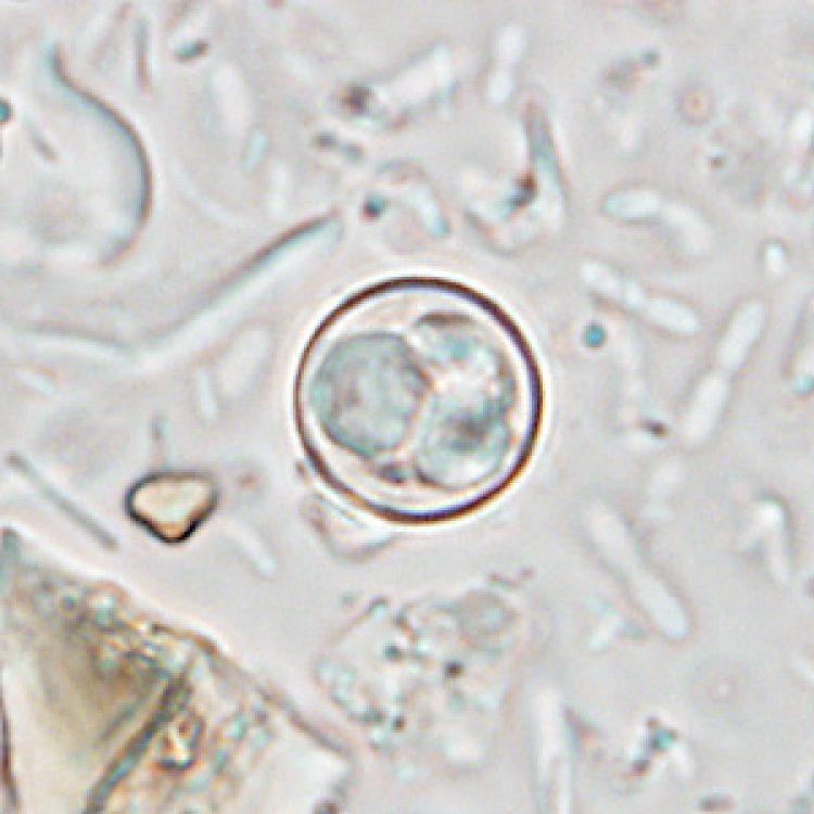Cyclospora is a round parasite. Image from CDC website.